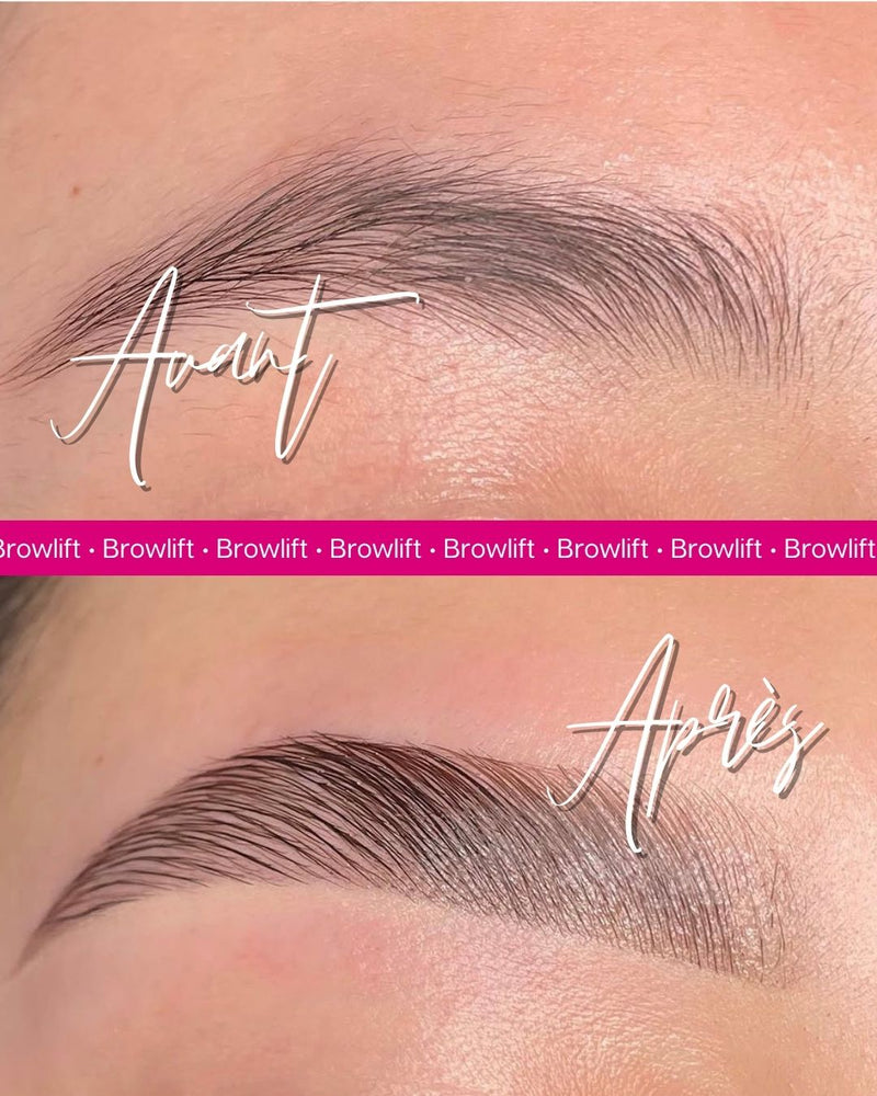 Formation brow lift Le Havre - photo 4