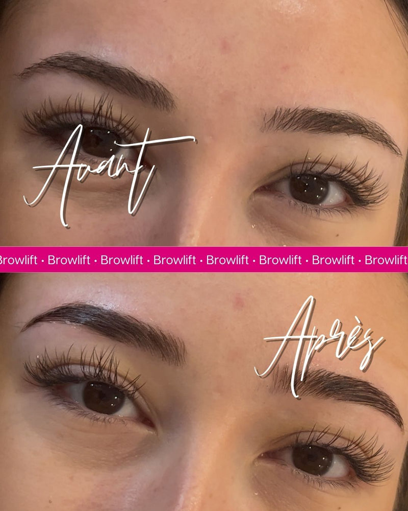 Formation brow lift Le Havre - photo 2