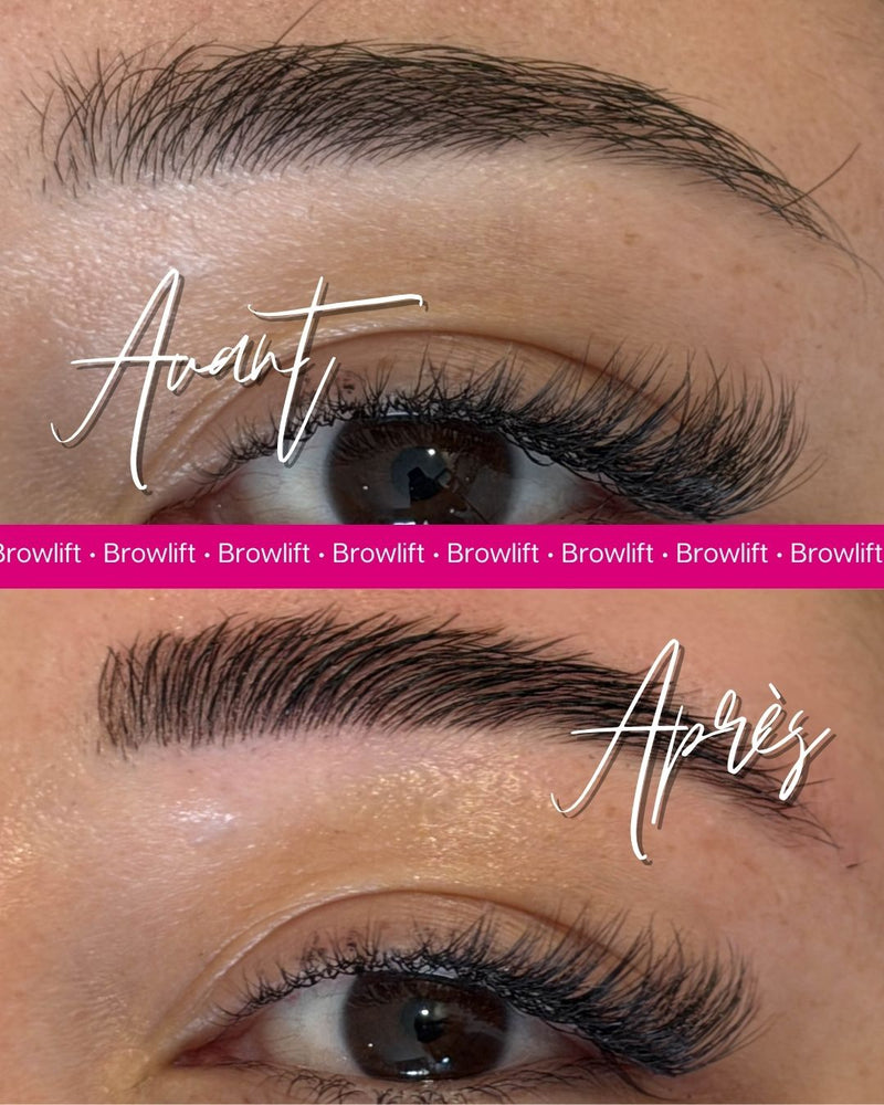 Formation brow lift Le Havre - photo 3
