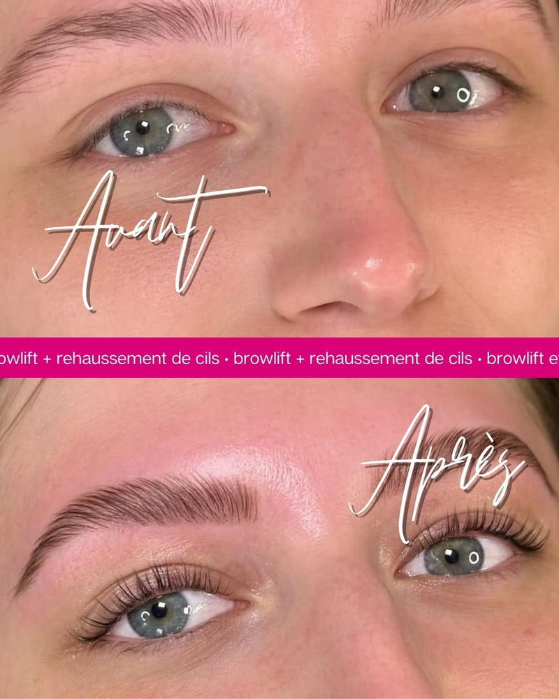 Formation brow lift Le Havre - photo 5